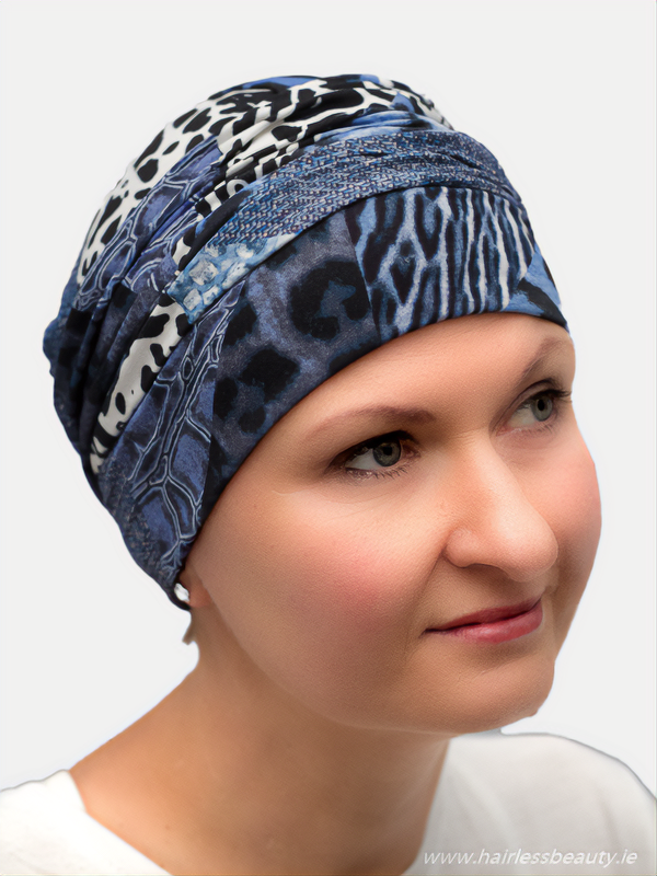 Soft, patterned turban offering full head coverage for hair loss